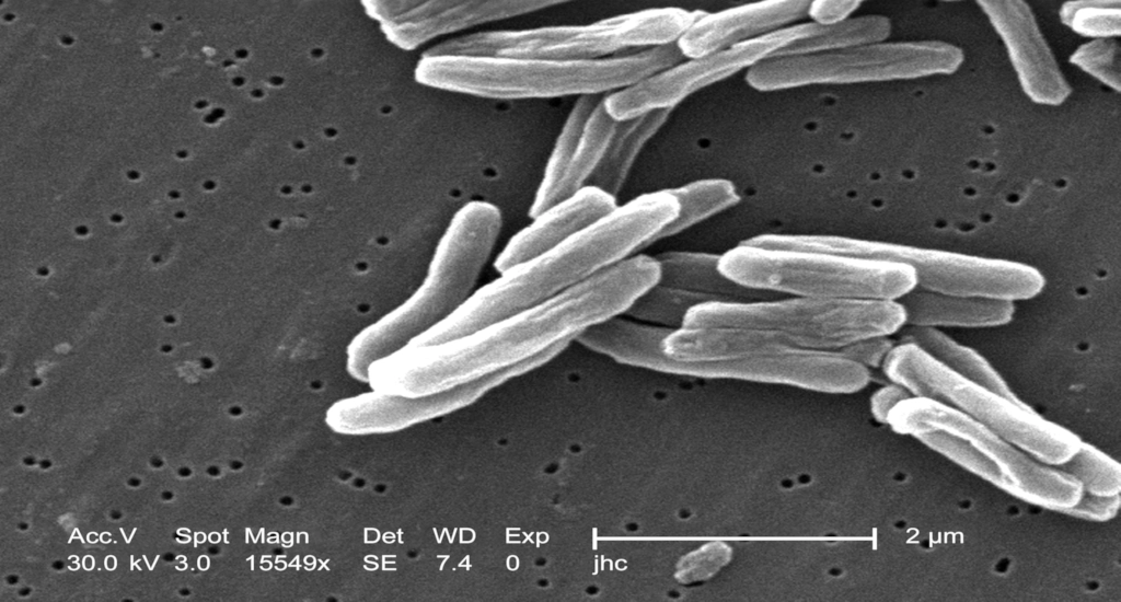 photo bacteria