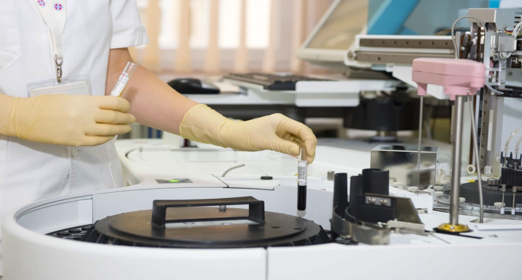 Stem-cell therapies show promise for repairing brains damaged by stroke