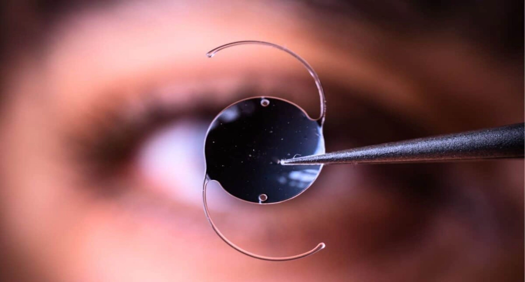 Science Corporation’s PRIMA Retinal Chip Launches in Europe, Promising Vision Restoration for AMD Patients